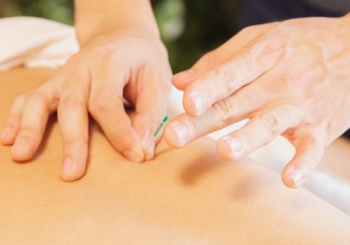 Acupuncture: An Overview of Alternative Treatments for Zoster Herpes